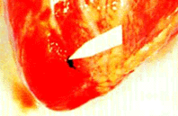 img25.gif