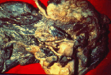 img65.gif
