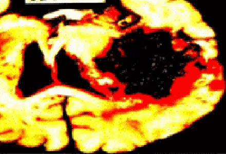 img69.gif