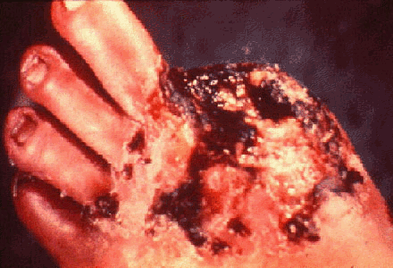 img71.gif