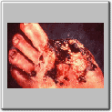 img71.gif
