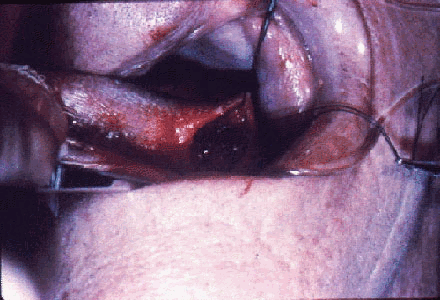 img72.gif