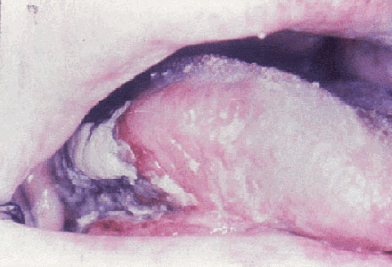 img73.gif