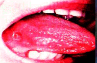 img81.gif