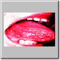 img81.gif