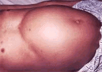 img85.gif