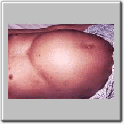 img85.gif