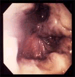 img87.gif