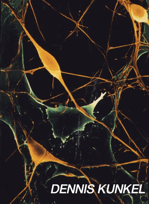 img5.gif